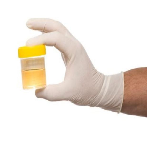 urine test